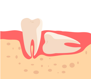 옆으로 누워있는 형태